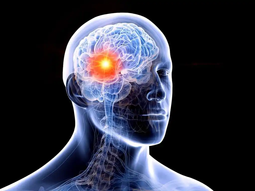 Un estudio reveló el fuerte impacto emocional y social que enfrenta quienes viven con epilepsia