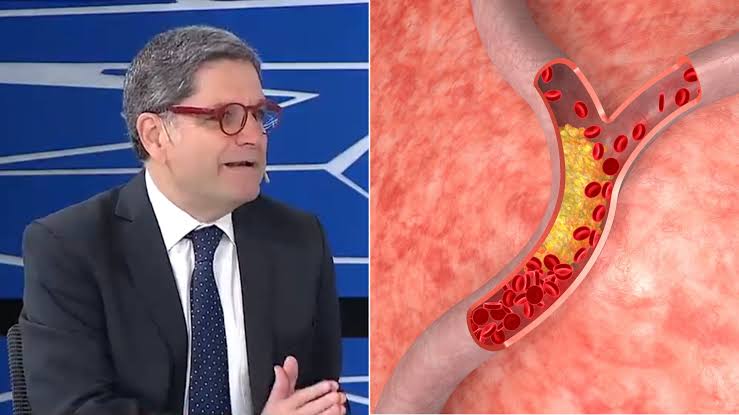 Colesterol y medicación: Tartaglione explicó cuándo las estatinas son necesarias